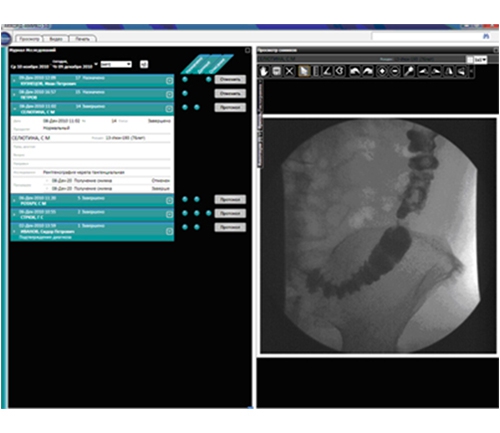 Устройство для цифровой обработки, визуализации и архивирования медицинских изображений УЦОИ-АККОРД